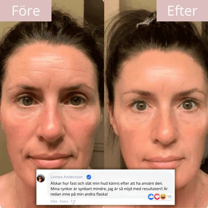 Renuvelle™ | Kollagen-Nattmask mot Fina Linjer