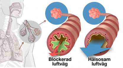 LungKlar™ | Andningstränare med justerbart motstånd