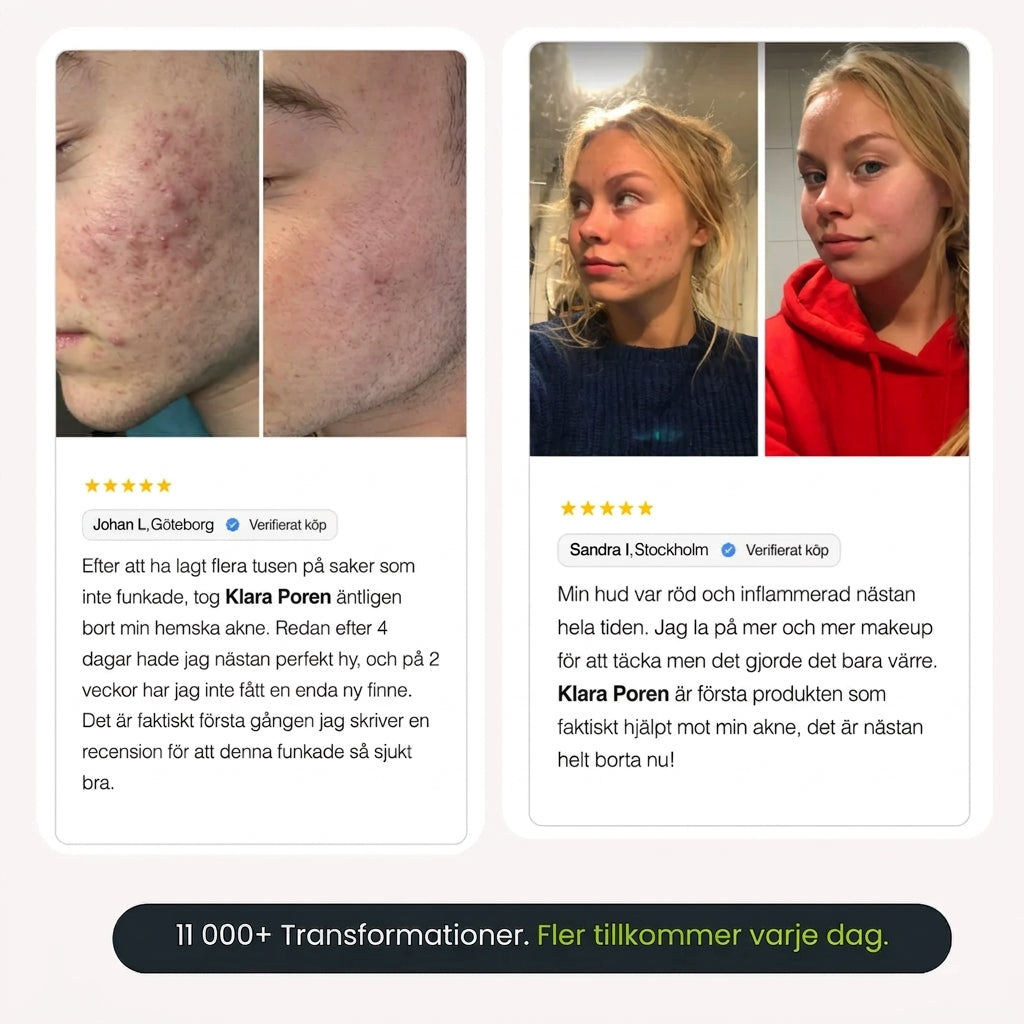 Klara Poren™ | Djuprengörande ansiktsmask i stick