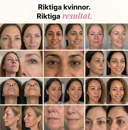 Rosalume™ | Kollagen Balm – För Fina Linjer & Strålande Hud